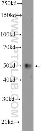 HERP Antibody in Western Blot (WB)