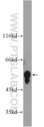 HERP Antibody in Western Blot (WB)