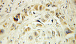 HERP Antibody in Immunohistochemistry (Paraffin) (IHC (P))