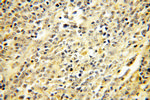 ERCC2 Antibody in Immunohistochemistry (Paraffin) (IHC (P))