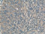 ERCC2 Antibody in Immunohistochemistry (Paraffin) (IHC (P))