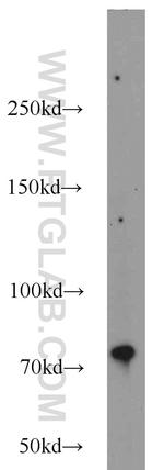 ERCC2 Antibody in Western Blot (WB)