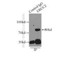 ERCC2 Antibody in Immunoprecipitation (IP)