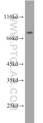 ERCC2 Antibody in Western Blot (WB)