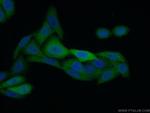 KPNA2 Antibody in Immunocytochemistry (ICC/IF)