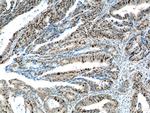 KPNA2 Antibody in Immunohistochemistry (Paraffin) (IHC (P))