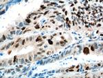 KPNA2 Antibody in Immunohistochemistry (Paraffin) (IHC (P))