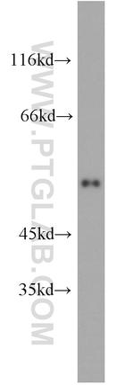 KPNA2 Antibody in Western Blot (WB)