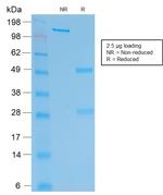 HCG-beta Antibody in SDS-PAGE (SDS-PAGE)