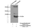 Cystatin B Antibody in Immunoprecipitation (IP)