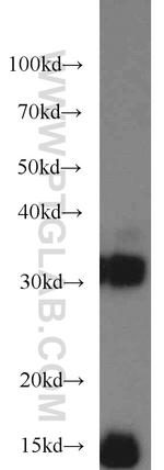 Cystatin B Antibody in Western Blot (WB)