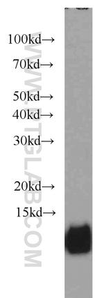 Cystatin B Antibody in Western Blot (WB)