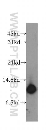 Cystatin B Antibody in Western Blot (WB)