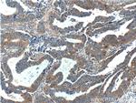 TPT1 Antibody in Immunohistochemistry (Paraffin) (IHC (P))