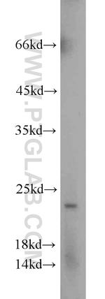 TPT1 Antibody in Western Blot (WB)