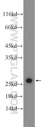 TPT1 Antibody in Western Blot (WB)