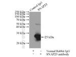 SNAP23 Antibody in Immunoprecipitation (IP)