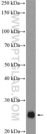 SNAP23 Antibody in Western Blot (WB)