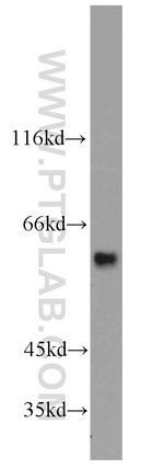 KAT5 Antibody in Western Blot (WB)