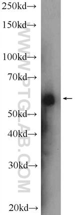 KAT5 Antibody in Western Blot (WB)