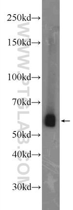 KAT5 Antibody in Western Blot (WB)