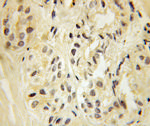 KAT5 Antibody in Immunohistochemistry (Paraffin) (IHC (P))