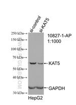 KAT5 Antibody in Western Blot (WB)