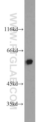 KAT5 Antibody in Western Blot (WB)