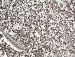 c-MYC Antibody in Immunohistochemistry (Paraffin) (IHC (P))