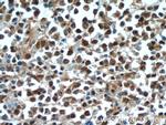 c-MYC Antibody in Immunohistochemistry (Paraffin) (IHC (P))