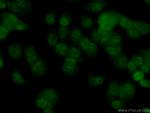 c-MYC Antibody in Immunocytochemistry (ICC/IF)