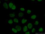 HMGB1 Antibody in Immunocytochemistry (ICC/IF)