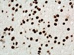 HMGB1 Antibody in Immunohistochemistry (Paraffin) (IHC (P))