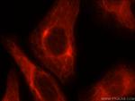 Cytokeratin 18 Antibody in Immunocytochemistry (ICC/IF)