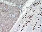 Cytokeratin 18 Antibody in Immunohistochemistry (Paraffin) (IHC (P))