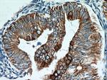 Cytokeratin 18 Antibody in Immunohistochemistry (Paraffin) (IHC (P))