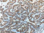 Cytokeratin 18 Antibody in Immunohistochemistry (Paraffin) (IHC (P))