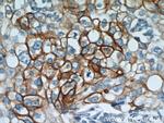 Cytokeratin 18 Antibody in Immunohistochemistry (Paraffin) (IHC (P))