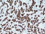 Cytokeratin 18 Antibody in Immunohistochemistry (Paraffin) (IHC (P))