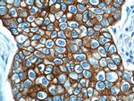 Cytokeratin 18 Antibody in Immunohistochemistry (Paraffin) (IHC (P))