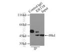 Cytokeratin 18 Antibody in Immunoprecipitation (IP)