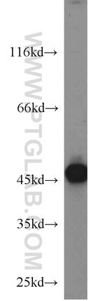 Cytokeratin 18 Antibody in Western Blot (WB)