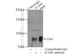 ICAM-1 Antibody in Immunoprecipitation (IP)