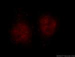 BMI1 Antibody in Immunocytochemistry (ICC/IF)