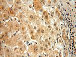 BMI1 Antibody in Immunohistochemistry (Paraffin) (IHC (P))