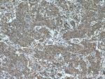 EPHX2 Antibody in Immunohistochemistry (Paraffin) (IHC (P))