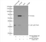 EPHX2 Antibody in Immunoprecipitation (IP)