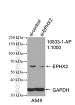 EPHX2 Antibody in Western Blot (WB)