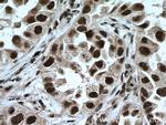 LSM4 Antibody in Immunohistochemistry (Paraffin) (IHC (P))