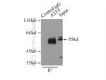 ATF4 Antibody in Immunoprecipitation (IP)